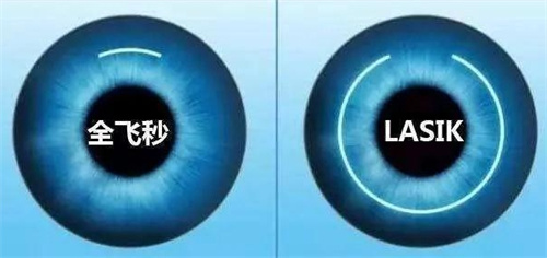 全飞秒和lasik对比图